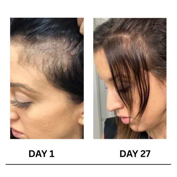 Kalwanji Shampoo CH6 (Dubai Import)