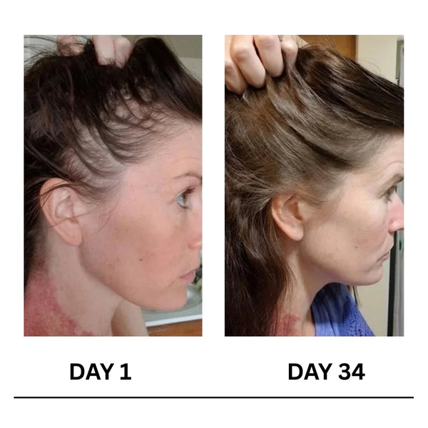 Kalwanji Shampoo CH6 (Dubai Import)