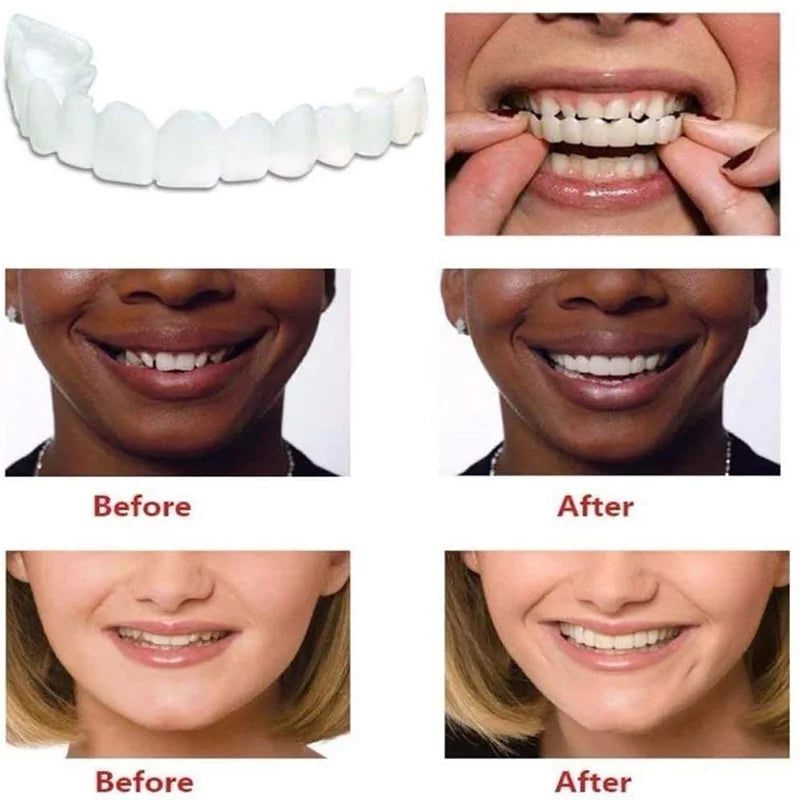 Instant Smile Reusable Snap On Veneers (Upper & Lower) Buy 1 get 1 free